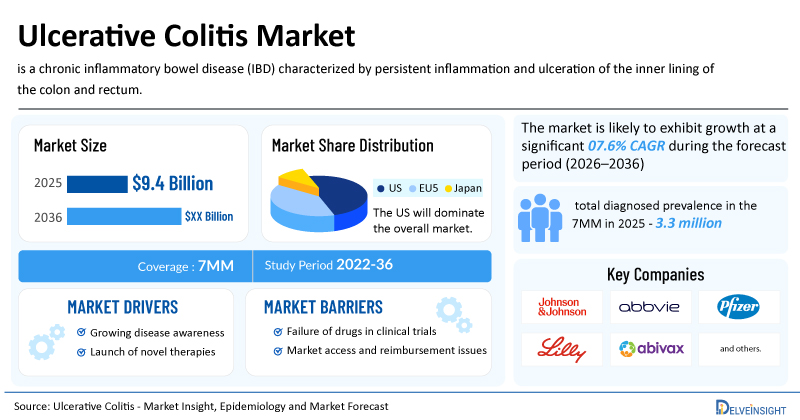 Ulcerative Colitis Market Outlook: 5 Late-Stage Drug Candidates to Watch | DelveInsight